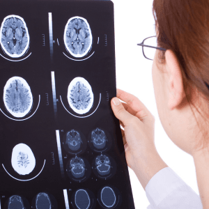 traumatic brain injury